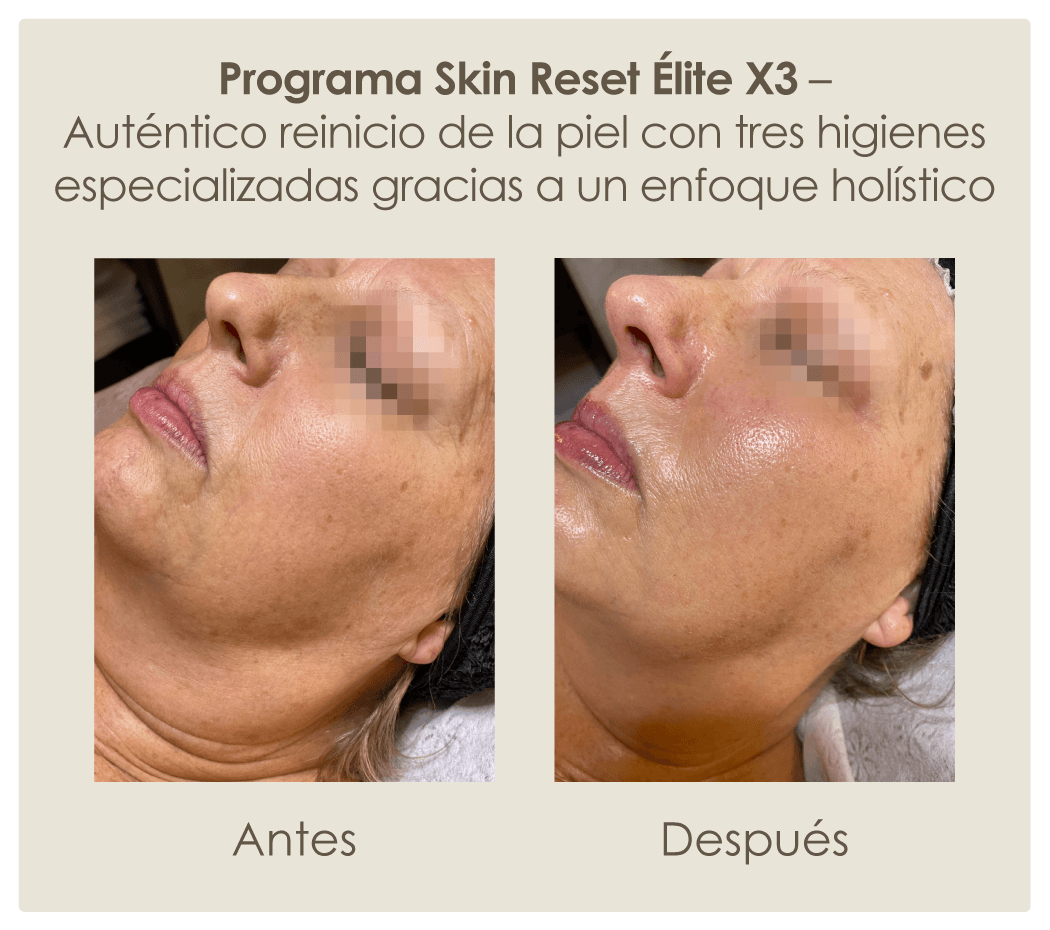 Auténtico-reinicio-de-la-piel-con-tres-higienes-especializadas-gracias-a-un-enfoque-holístico