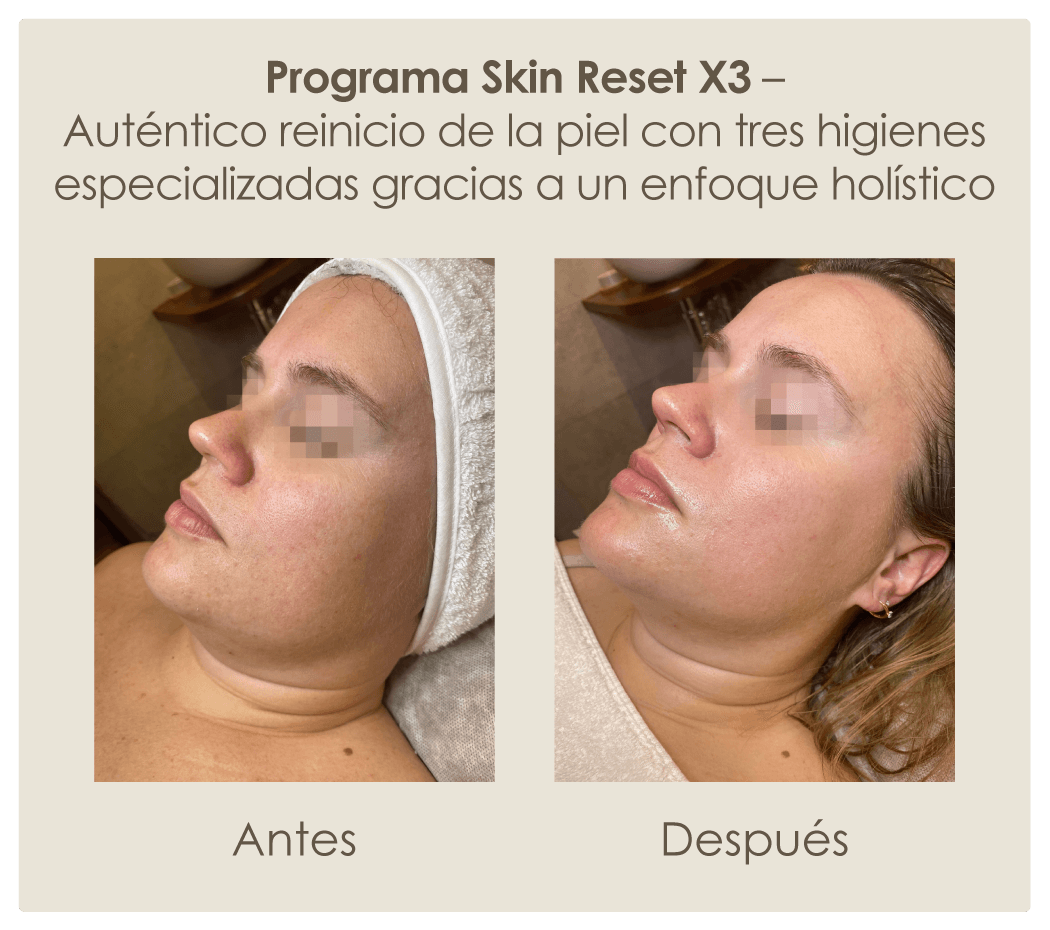 Programa-Skin-Reset-X3