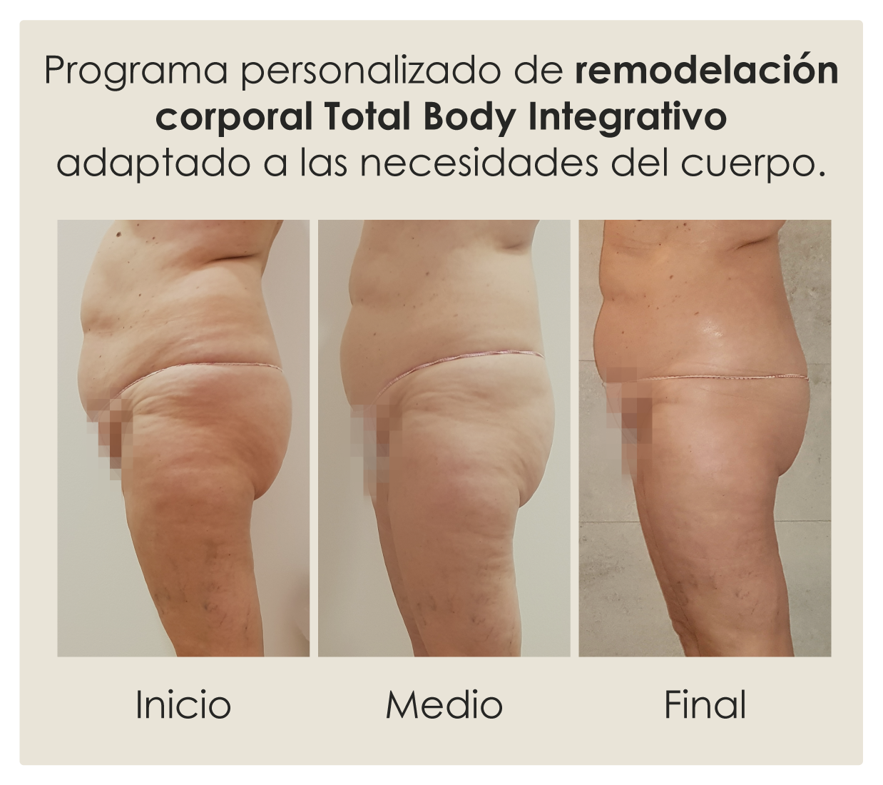 Programa de remodelación corporal